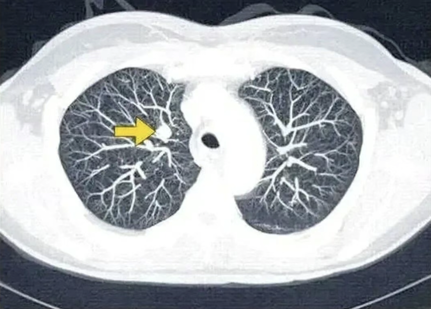 截屏2026-01-09 09.13.23.png